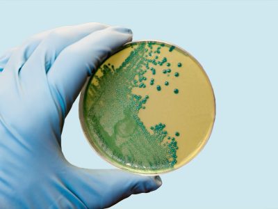 Uitbraak van Listeria in verband met vleeswaren leidt tot waarschuwing van CDC