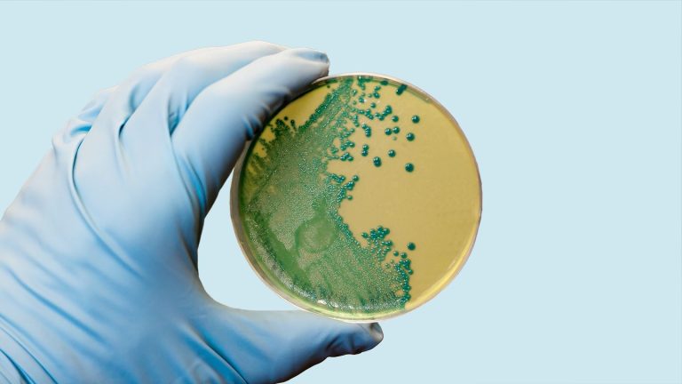 Uitbraak van Listeria in verband met vleeswaren leidt tot waarschuwing van CDC